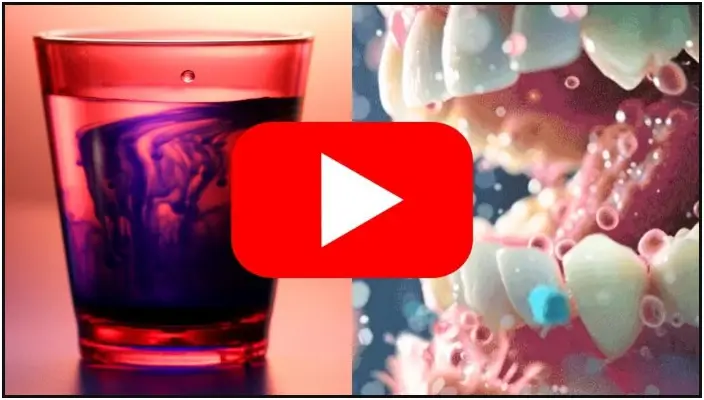 bleeding gums treatment thumbnail